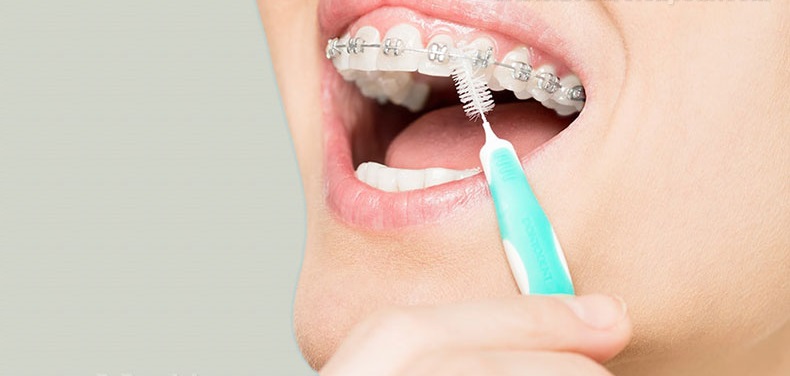 مسواک بین دندانی چیست و چه کاربردی دارد ؟