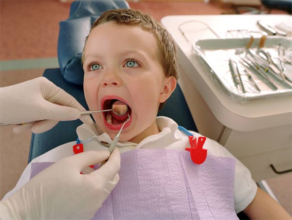 علت ترومای دندان کودک 