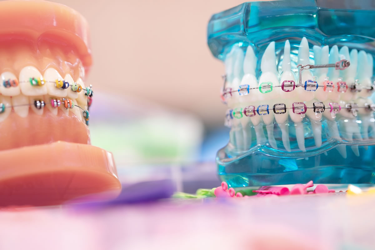 ارتودنسی دندان چیست و چه مزایایی دارد ؟