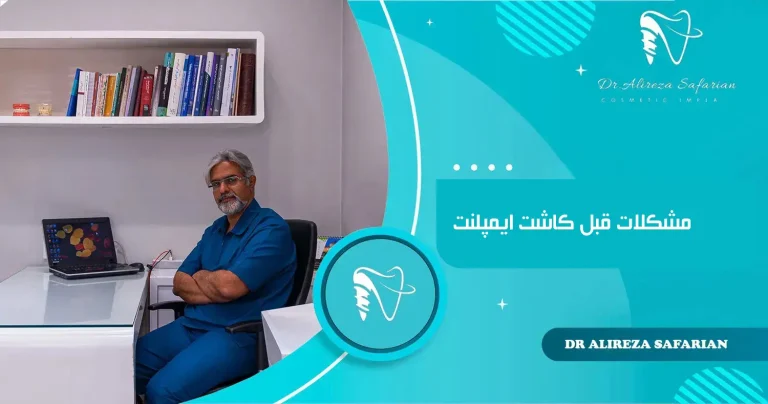 مشکلات قبل کاشت ایمپلنت
