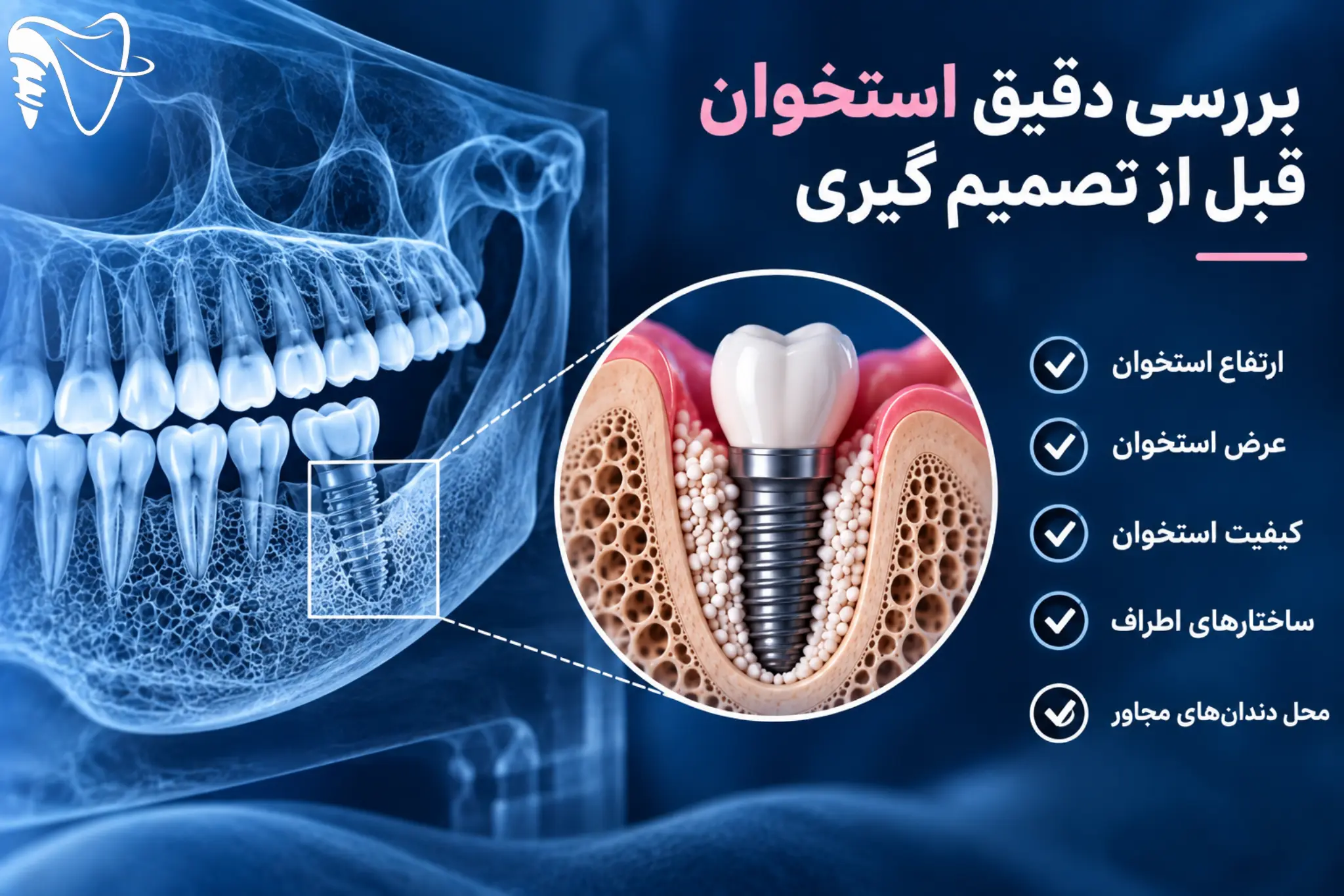 از کجا بفهمیم استخوان کافی داریم؟
