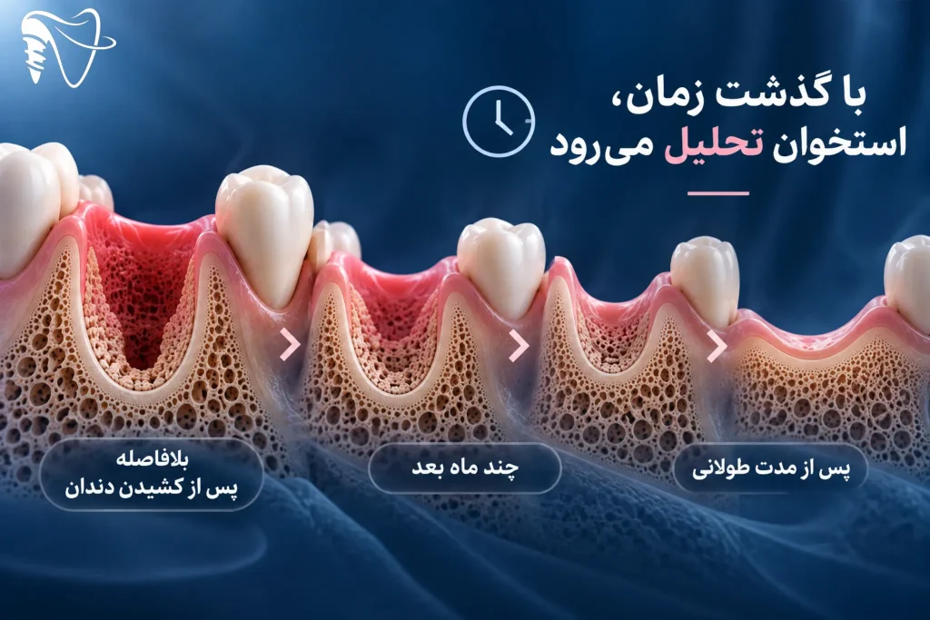 چرا بعد از کشیدن دندان استخوان تحلیل می‌رود؟
