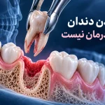 چرا نباید بعد از کشیدن دندان، جای خالی آن را نادیده گرفت؟