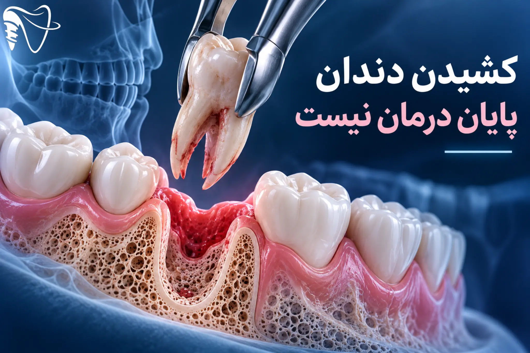 چرا نباید بعد از کشیدن دندان، جای خالی آن را نادیده گرفت؟