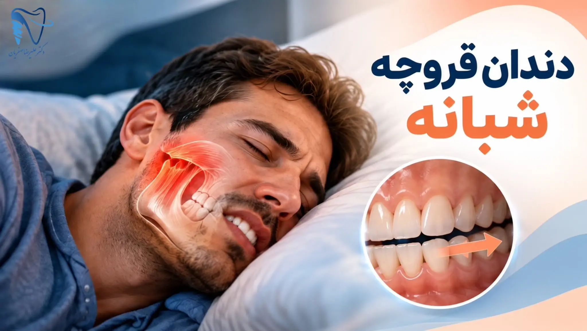 دندان‌قروچه شبانه دقیقاً چیست؟