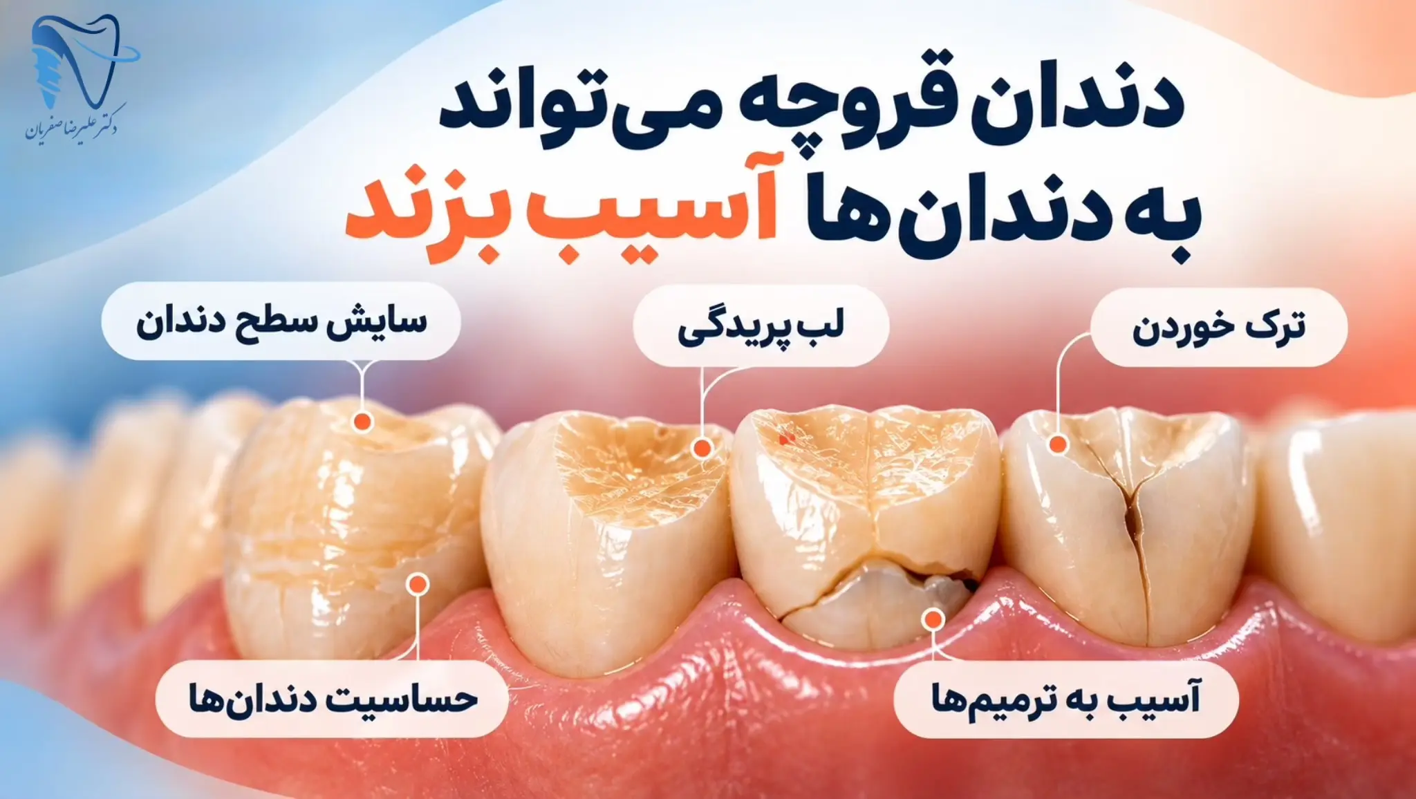 چه زمانی بهتر است برای دندان‌قروچه مراجعه کنیم؟